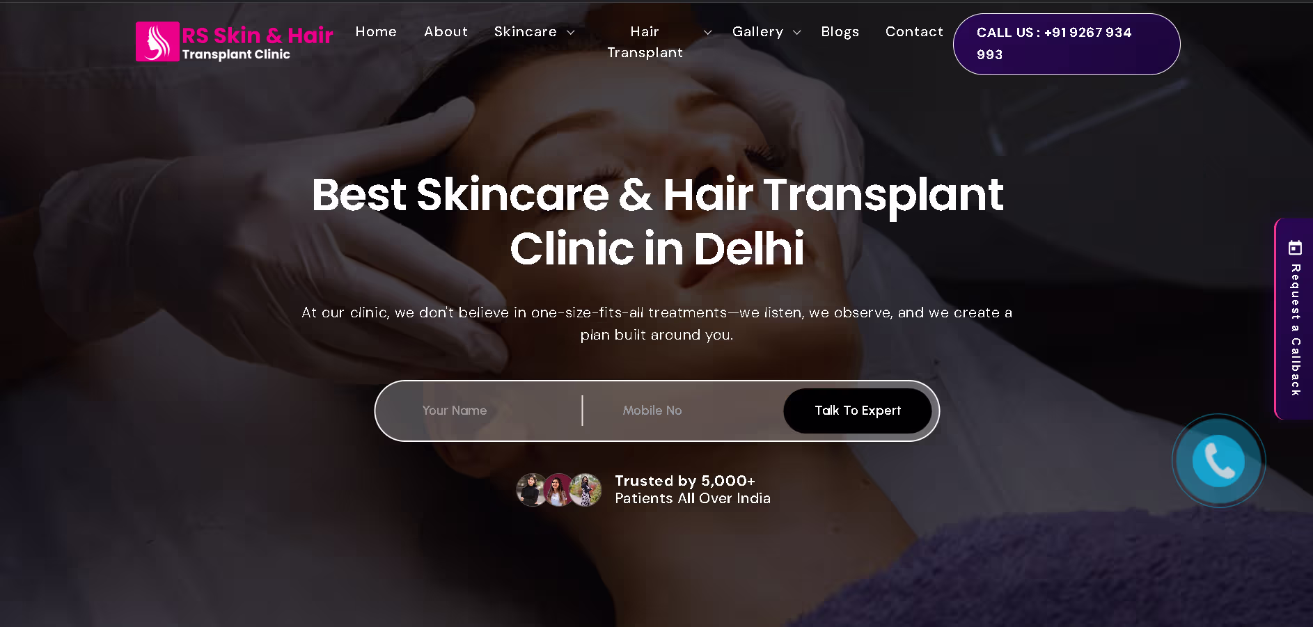 RS Skin & Hair Transplant Clinic website project screenshot